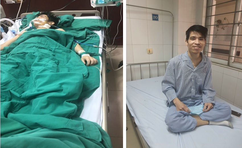 MỔ CẤP CỨU THÀNH CÔNG BỆNH NHÂN BỊ SỐC MẤT MÁU NẶNG DO U GAN VỠ MỔ CẤP CỨU THÀNH CÔNG BỆNH NHÂN BỊ SỐC MẤT MÁU NẶNG DO U GAN VỠ