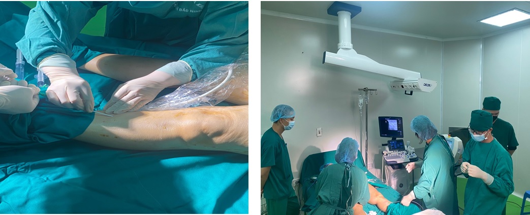 TRIỂN KHAI THÀNH CÔNG KỸ THUẬT MỚI VƯỢT TUYẾN “ĐIỀU TRỊ SUY TĨNH MẠCH BẰNG LASER NỘI MẠCH”